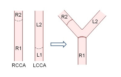 Constructed Y bifurcation