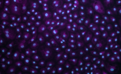 immunostain